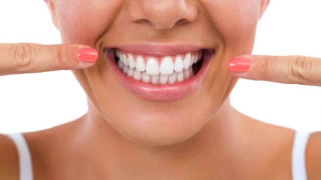 Why You Should Choose Dental Implants?