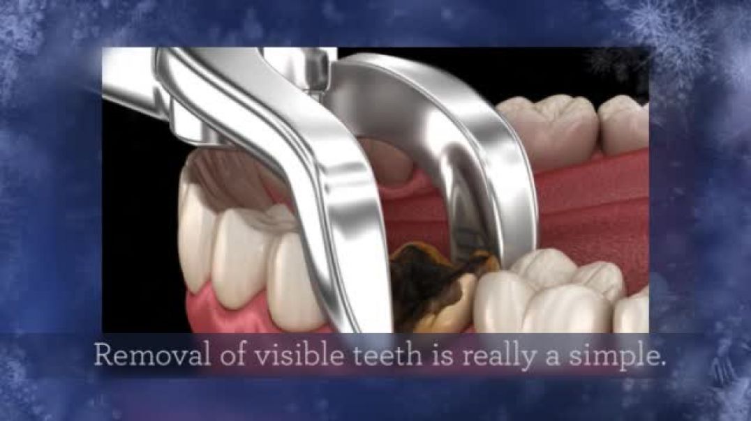 Fix the Issue for Missing Teeth